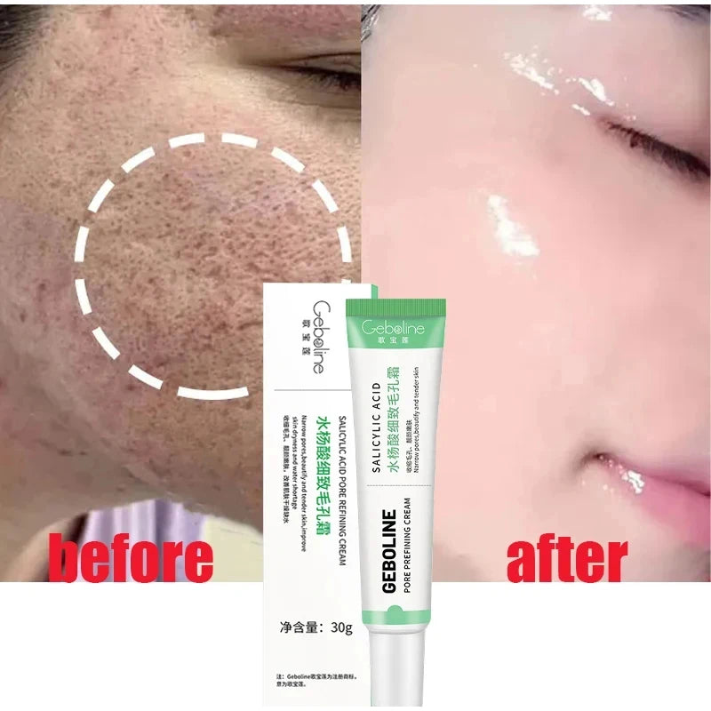 Salicylic Acid Pore Shrinking Cream Quick Elimination Large Pores Remove Blackehead Tighten Face Smooth Skin Care Products