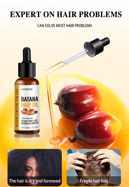 Fast Hair Growth Oil Africa Crazy Traction Alopecia batana Hair Mask Anti Hair Break Hair Strengthener Hair Loss Treatment Spray