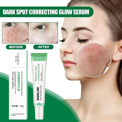 Salicylic Acid Pore Shrinking Cream Quick Elimination Large Pores Remove Blackehead Tighten Face Smooth Skin Care Products