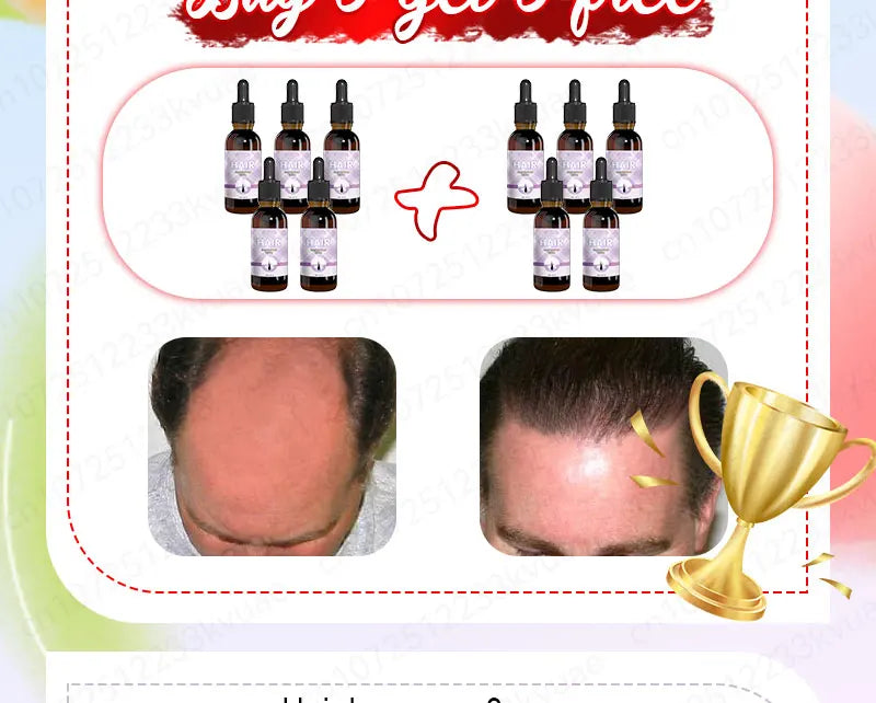 Hair growth essential oil. Effectively repairs baldness and hair loss symptoms, suitable for both men and women