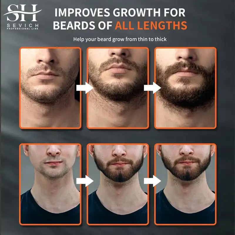 New 2023 Chebe Beard Growth Oil For Men Fast Effective Beard Growth Essential Hair Loss Treatment Product Sevich Beard Care 30ml