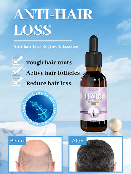 Hair growth essential oil. Effectively repairs baldness and hair loss symptoms, suitable for both men and women