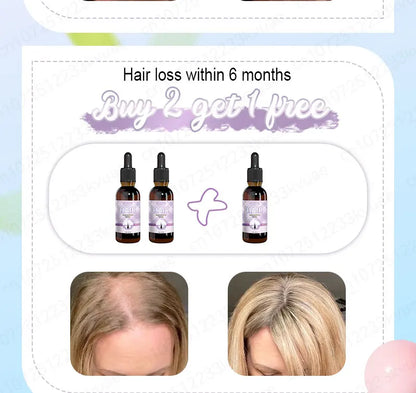 Hair growth essential oil. Effectively repairs baldness and hair loss symptoms, suitable for both men and women