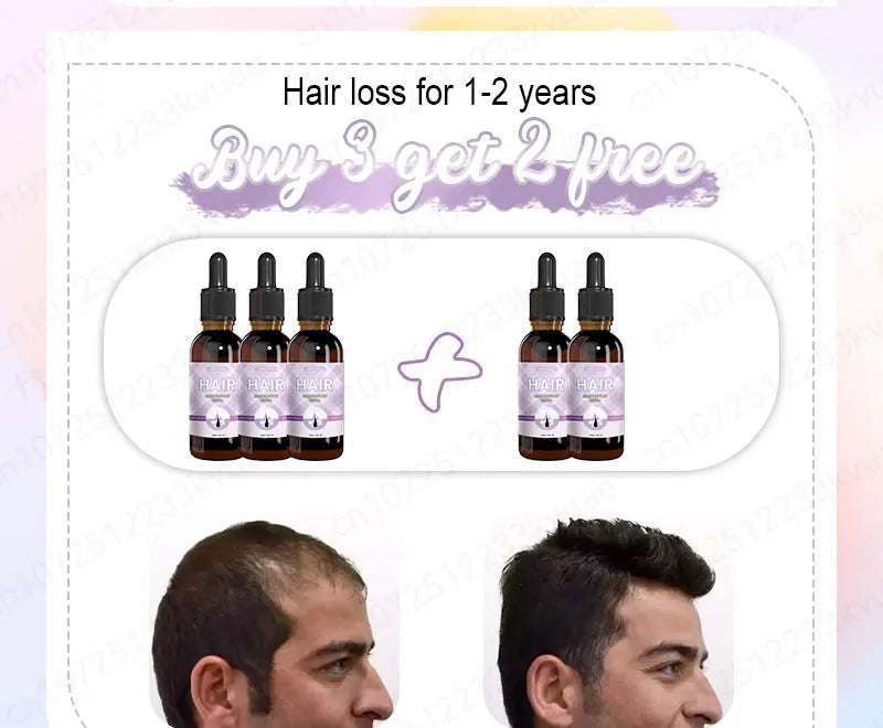 Hair growth essential oil. Effectively repairs baldness and hair loss symptoms, suitable for both men and women