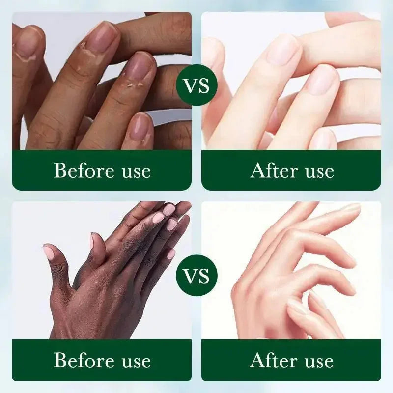 Fast Whitening Dark Knuckles Brighten Hand Cream Melanin Corrector Moisturize Nourishing Hand Protection Skin Care Products