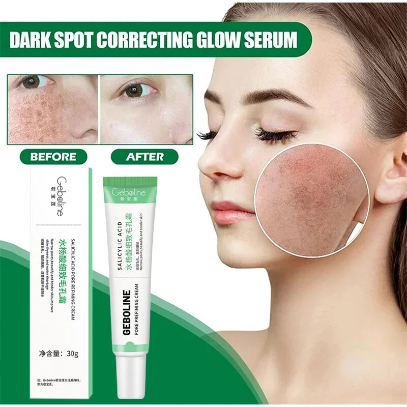 Salicylic Acid Pore Shrinking Cream Quick Elimination Large Pores Remove Blackehead Tighten Face Smooth Skin Care Products