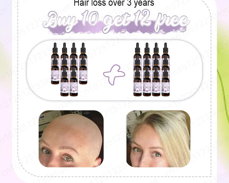 Hair growth essential oil. Effectively repairs baldness and hair loss symptoms, suitable for both men and women