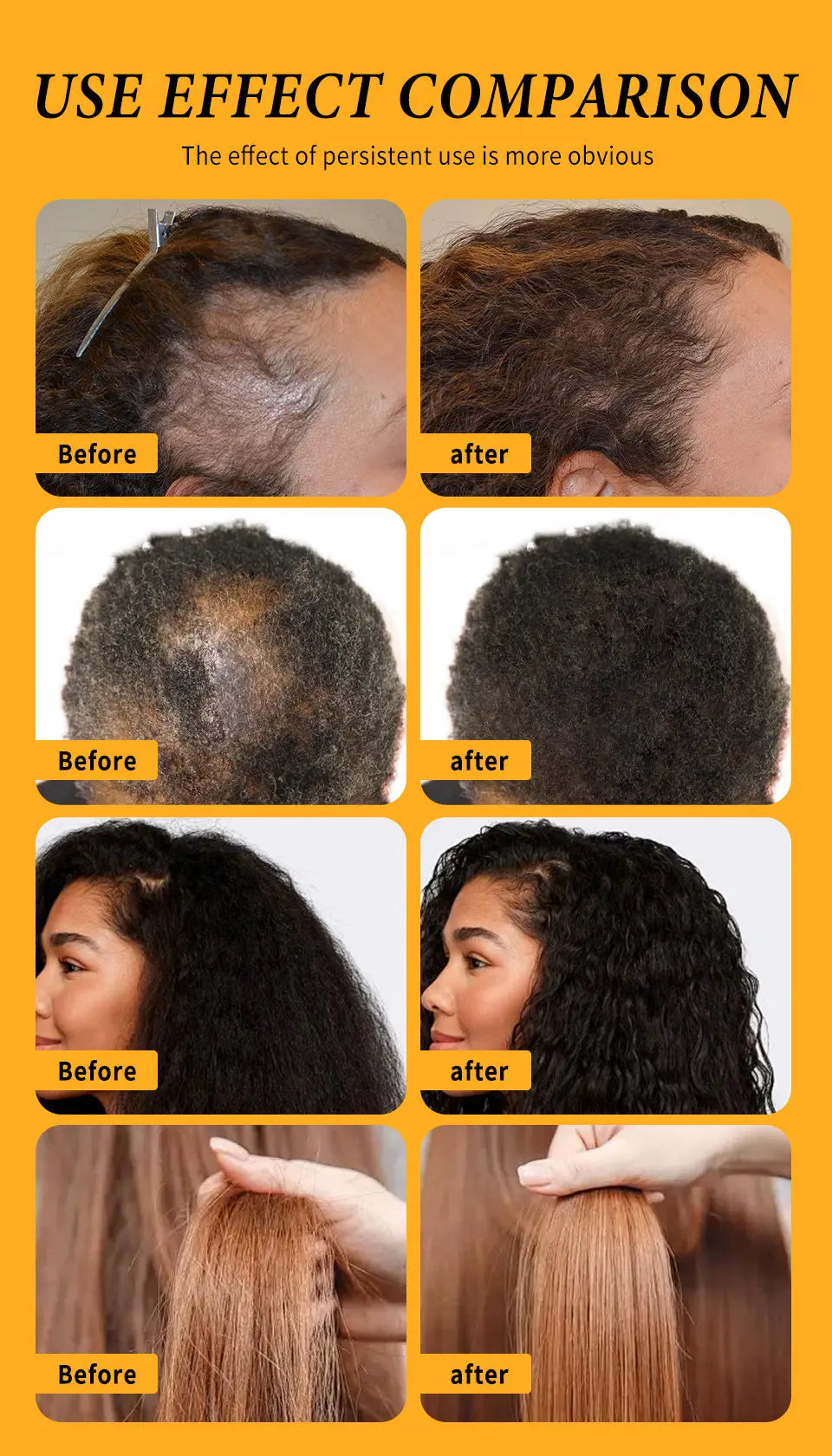 Fast Hair Growth Oil Africa Crazy Traction Alopecia batana Hair Mask Anti Hair Break Hair Strengthener Hair Loss Treatment Spray