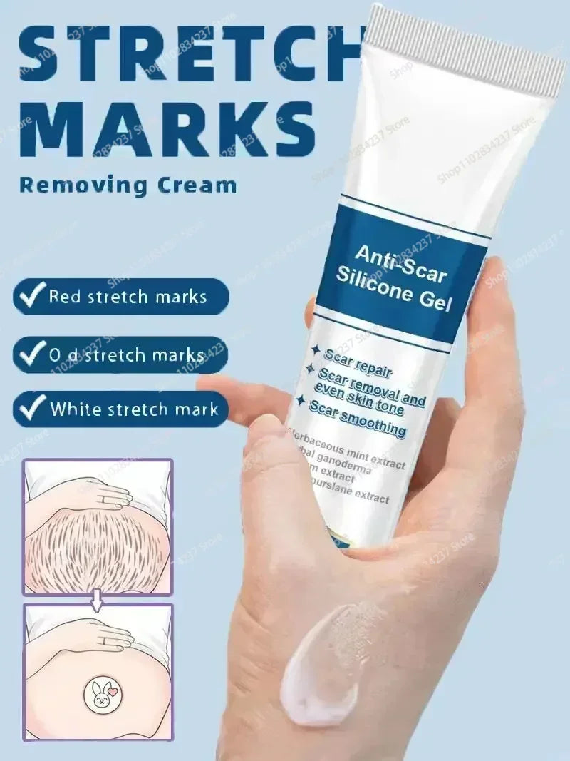 Eliminate Old Stretch Marks Cream For Pregnancy Postpartum Skin Care Gel