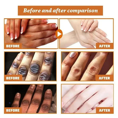 Fast Whitening Dark Knuckles Brighten Hand Cream Melanin Corrector Moisturizing Intense Stains Remover Products Skin Care