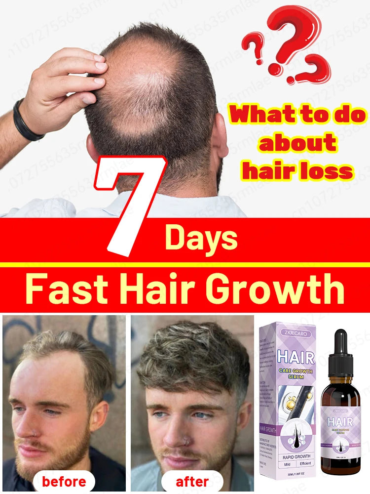 Hair growth essential oil. Effectively repairs baldness and hair loss symptoms, suitable for both men and women