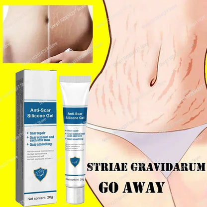 Eliminate Old Stretch Marks Cream For Pregnancy Postpartum Skin Care Gel