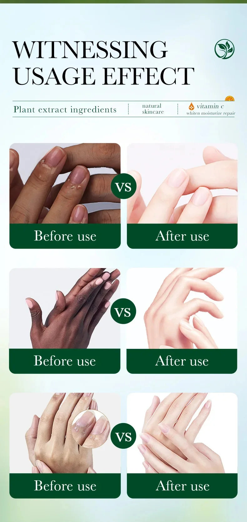 Fast Whitening Dark Knuckles Brighten Hand Cream Melanin Corrector Moisturizing Intense Stains Remover Products Skin Care