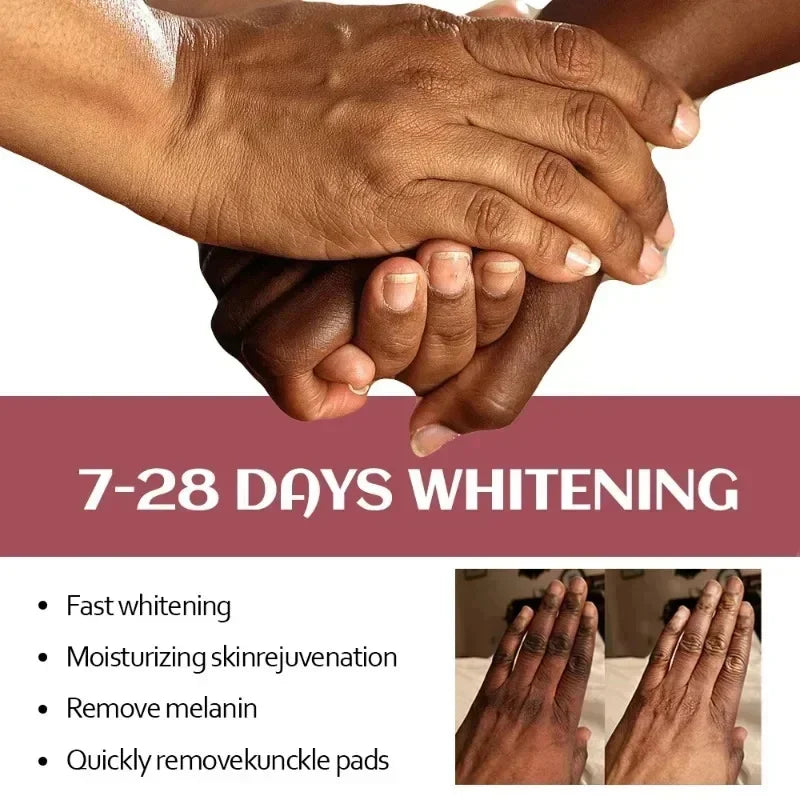 Fast Whitening Dark Knuckles Brighten Hand Cream Melanin Corrector Moisturize Nourishing Hand Protection Skin Care Products