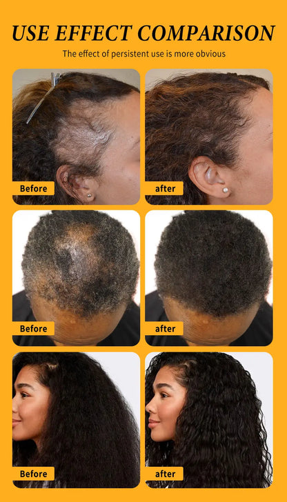 Fast Hair Growth Oil Africa Crazy Traction Alopecia batana Hair Mask Anti Hair Break Hair Strengthener Hair Loss Treatment Spray