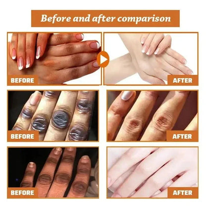 Fast Whitening Dark Knuckles Brighten Hand Cream Melanin Corrector Moisturize Nourishing Hand Protection Skin Care Products