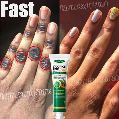 Fast Whitening Dark Knuckles Brighten Hand Cream Melanin Corrector Moisturizing Intense Stains Remover Products Skin Care